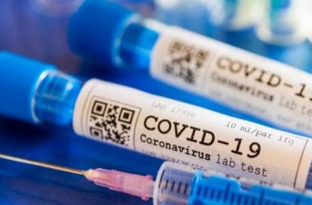На Сумщине коронавирус подтвердили еще у 289 человек